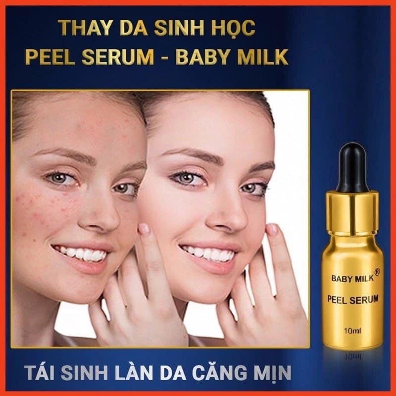 [Hot] Thay Da Sinh Học Peel Serum Baby Milk 10ml - Hàng Hiệu Cao Thiên Nhi
