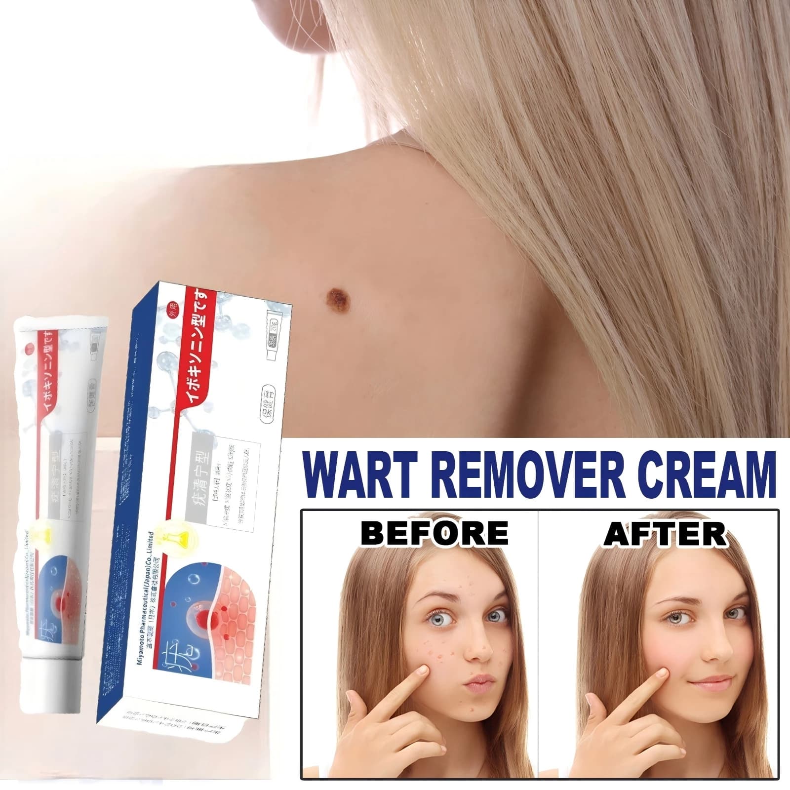Kem bôi loại bỏ mụn cóc và nốt ruồi Nhật Bản, kem tẩy mụn cóc, kem loại bỏ đốm đen